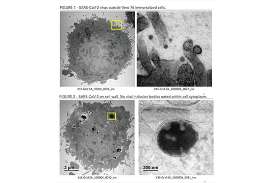 Further Evidence of Xylitol’s Effectiveness Against Viruses